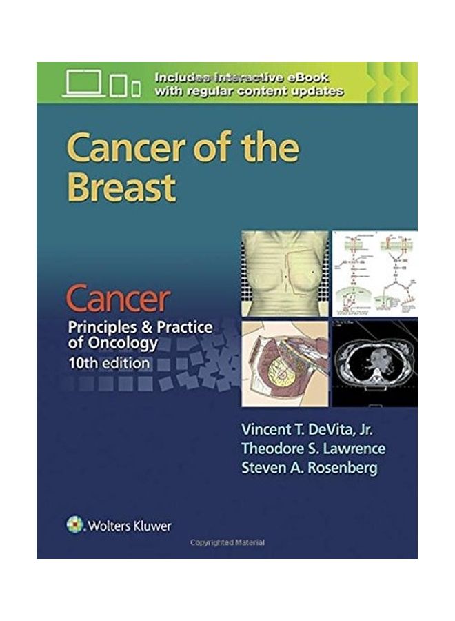 Cancer of the Breast: From Cancer: Principles & Practice of Oncology, 10th Edition paperback english - 2016  - Image 1