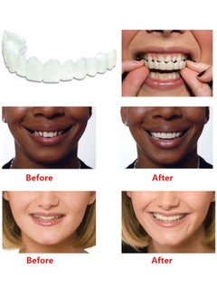 Generic Teeth Whitening Teeth Cover Perfect Smile Comfort Fit Flex Teeth Veneers Upper Teeth + Lower Teeth Set Style:combination white 10*10*10cm  - Image 2