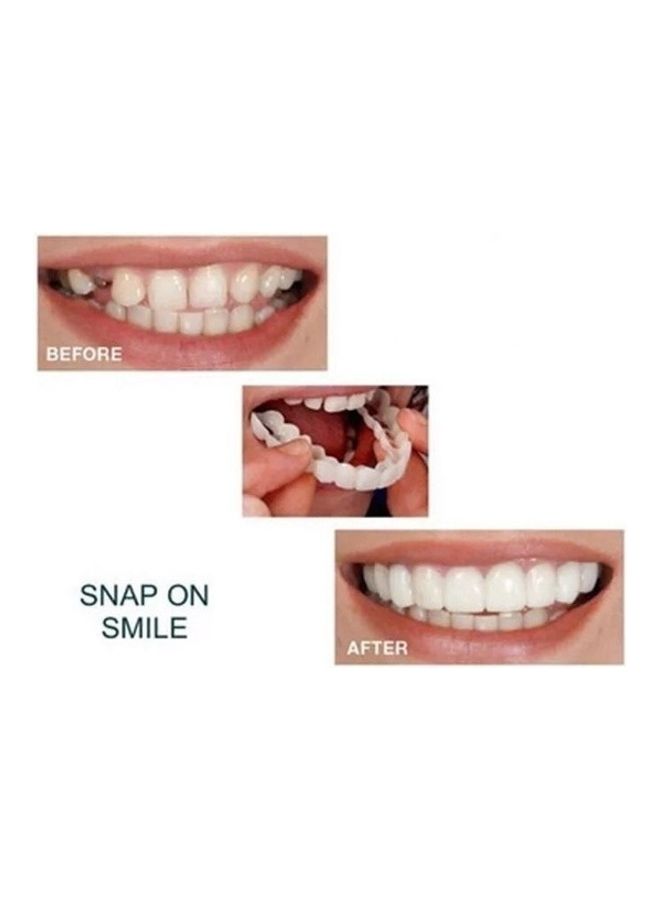 Generic - 2Pair / 4PCS Teeth Whitening Artificial Dentures Dental Tools Disposable Braces Mouth Tray multicolor 7*7*7cm - Image 1