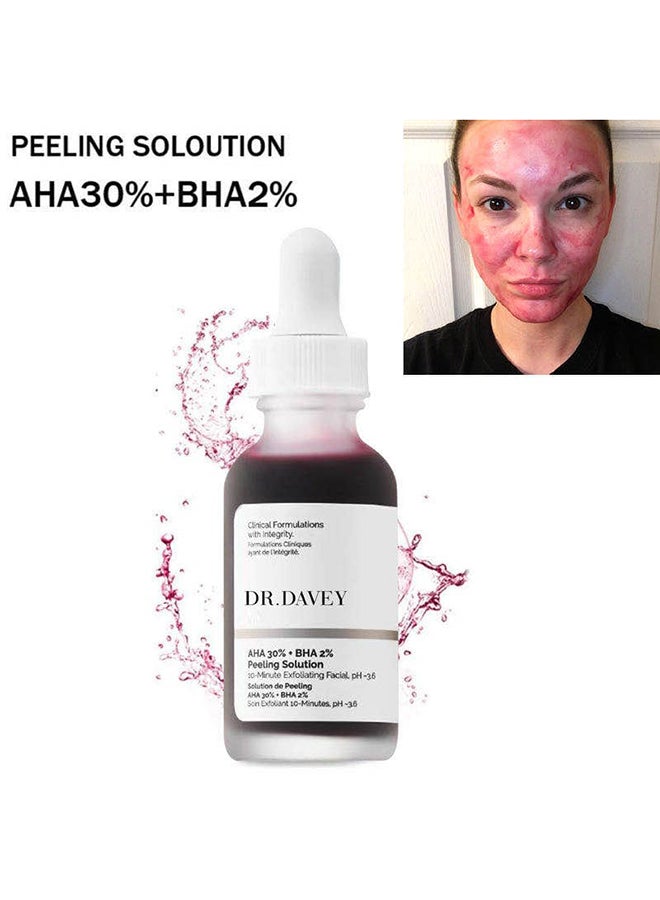 Peeling Solution 30ml