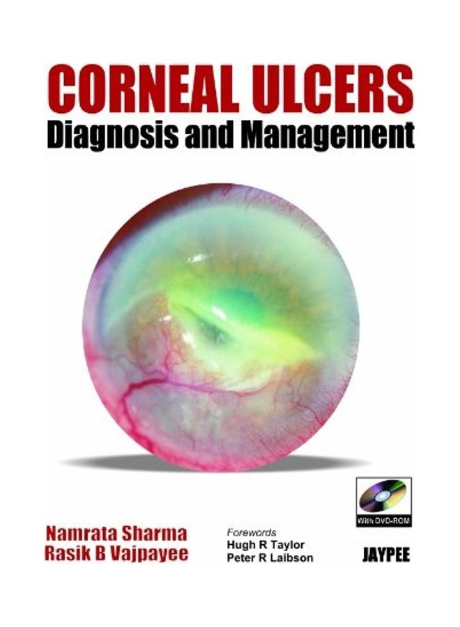 Corneal Ulcers Diagnosis And Management paperback english - 2008 - Image 1
