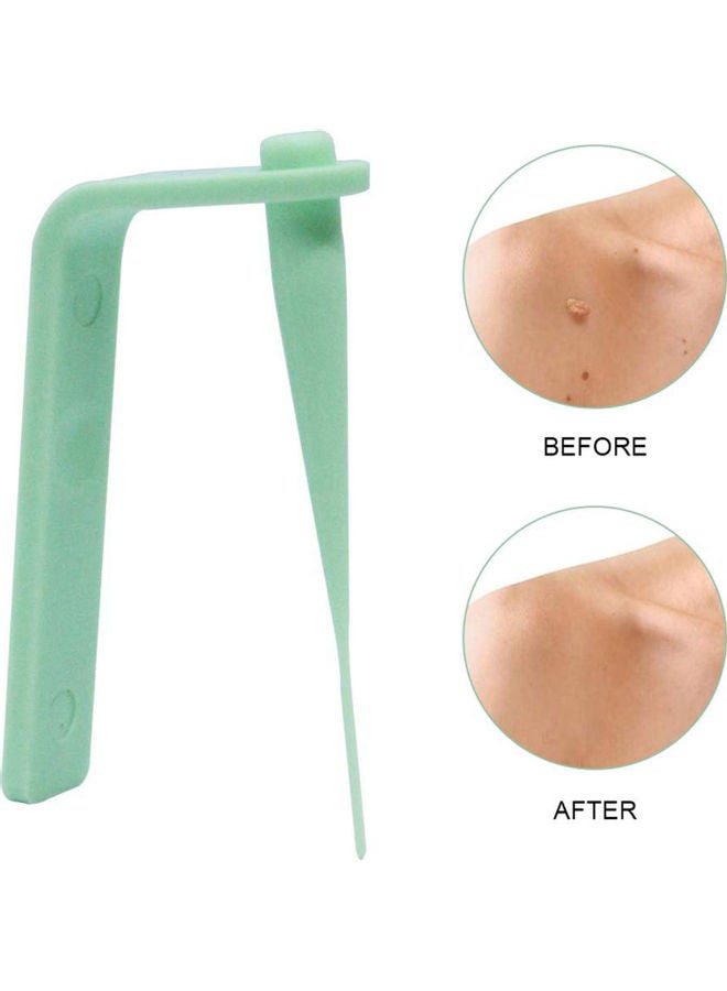 Generic - Skin Tag Removal Kit Skin Tag Remover Skin Mole Wart Remover Micro Band Skin Tag Removal Kit with Cleansing Pads Mole Face Care Green - Image 1