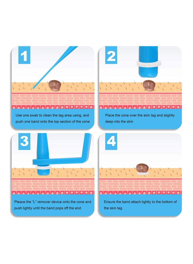 Generic - Skin Tag Removal Kit Skin Tag Remover Skin Mole Wart Remover Micro Band Skin Tag Removal Kit with Cleansing Pads Mole Face Care Green - Image 1