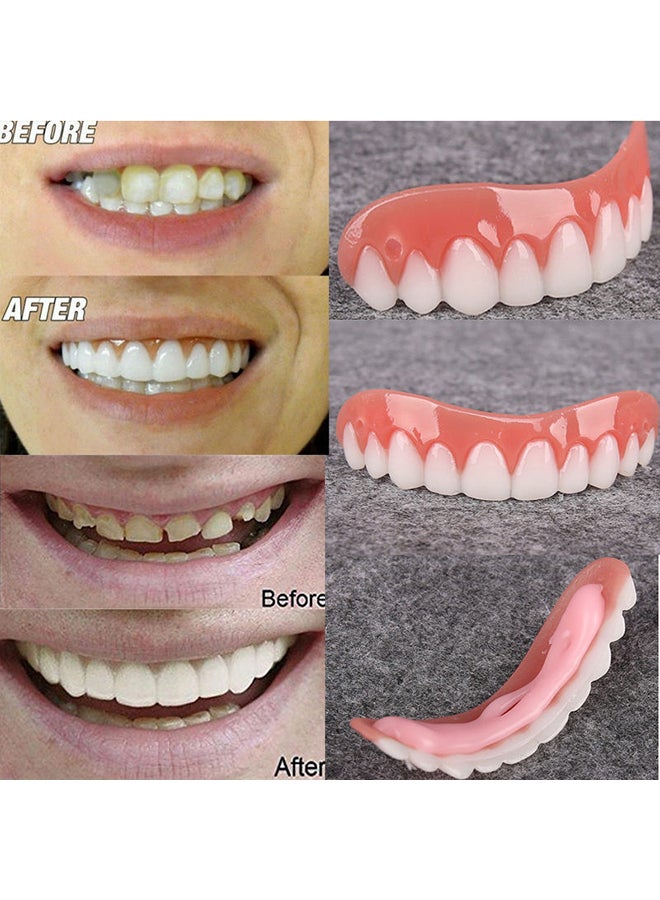 Silicone Smile Veneers Simulation Braces Flex Denture Paste multicolor 13*13*13cm - Image 4