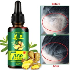 Clothes of skin Effective Scalp Nutritious Hair Growth Essence Oil Green 30ml  - Image 2