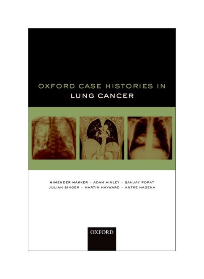 Oxford Case Histories In Lung Cancer paperback english - 15 Jan 2019 