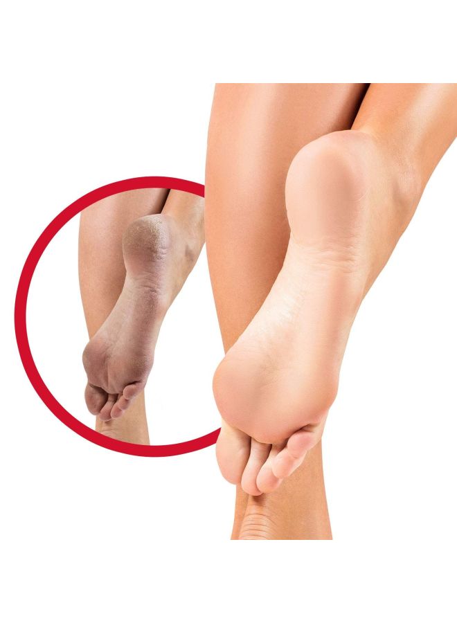 Flexitol Callus Remover Cream 56grams - Image 3