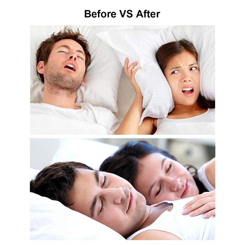Woodyknows - Anti Snoring Nasal Dilators - Image 1