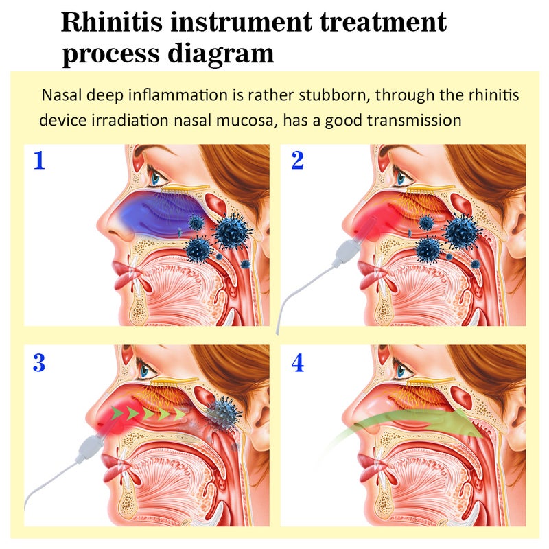Househeld Rhinitis Laser Therapeutic Apparatus Instrument - Image 4