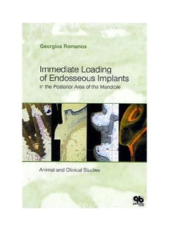Immediate Loading Of Endosseous Implants In The Posterior Area Of The Maudible Hardcover English by G.E. Ramanos