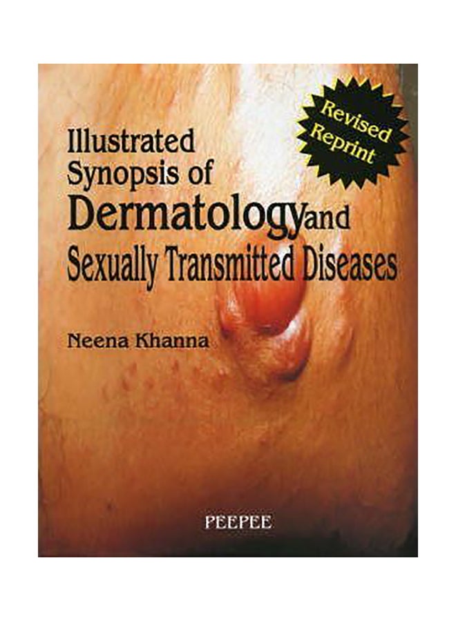 ملخص مصور للأمراض الجلدية والأمراض المنقولة جنسياً