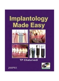 Implantology Made Easy Paperback English by TP Chaturvedi
