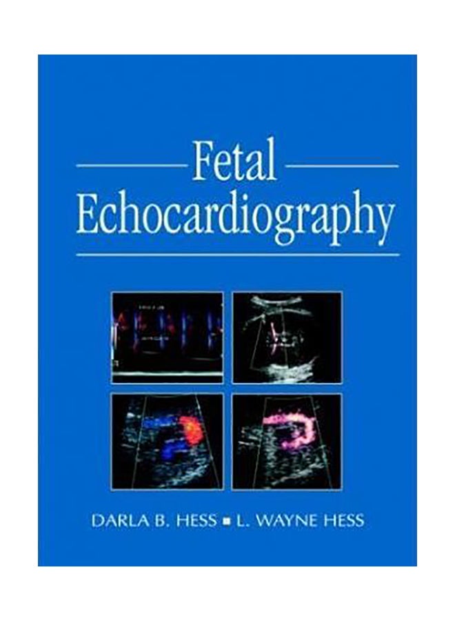 Fetal Echocardiography Hardcover English by Darla B. Hess