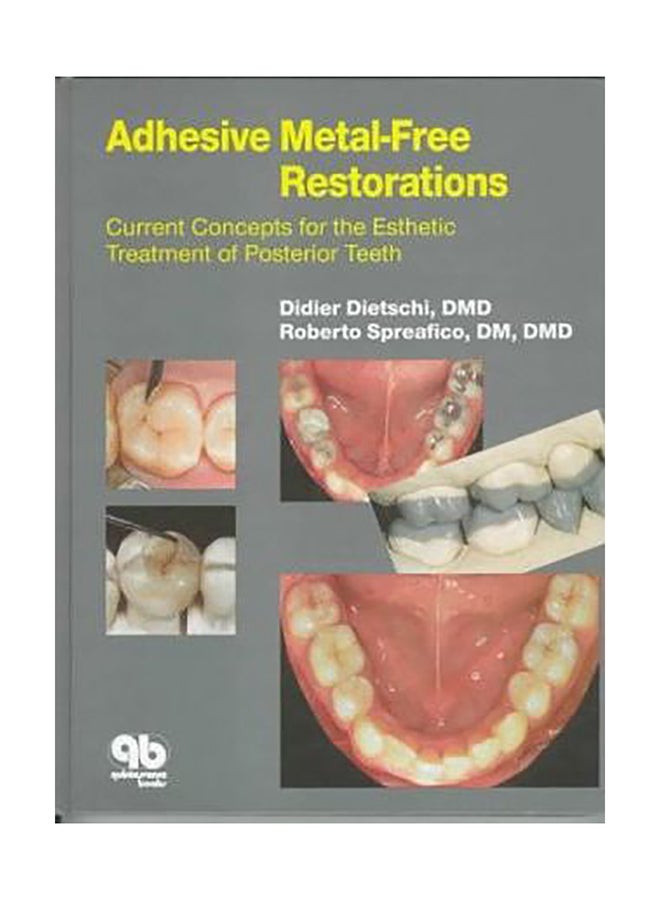 Adhesive Metal-Free Restorations: Current Concepts In The Aesthetic Treatment Of Posterior Teeth Hardcover English by Didier Dietschi - 35431 