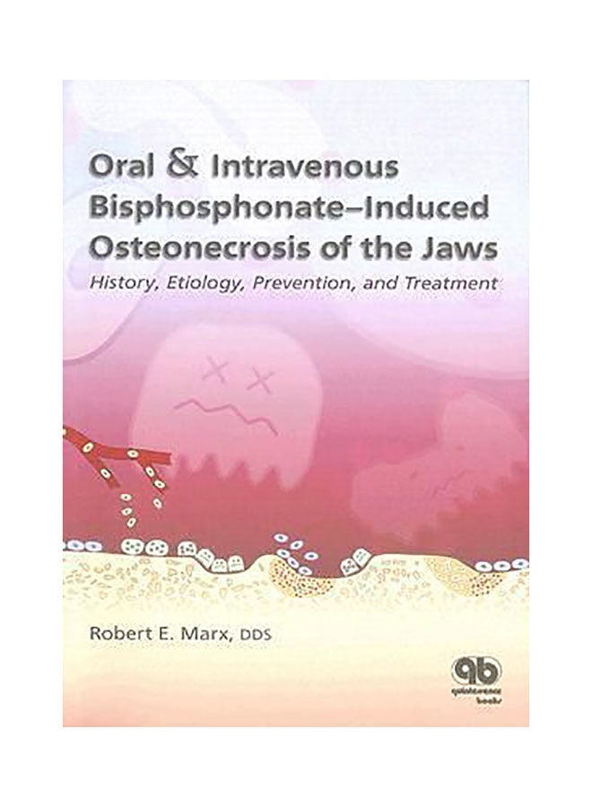 Oral And Intravenous Bisphosphonate-Induced Osteonecrosis Of The Jaws : History, Etiology, Prevention And Treatment Paperback English by Robert E. Marx - 01032018