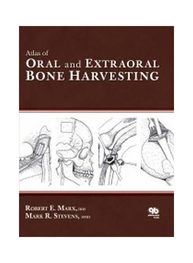 Atlas Of Oral And Extraoral Bone Harvesting Hardcover English by Robert E. Marx - 01032018