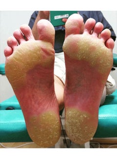 Flexitol Hard Skin And Callus Balm  - Image 3