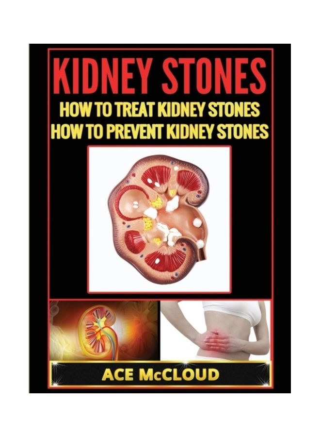 Kidney Stones: How To Treat Kidney Stones: How To Prevent Kidney Stones hardcover english  - Image 3