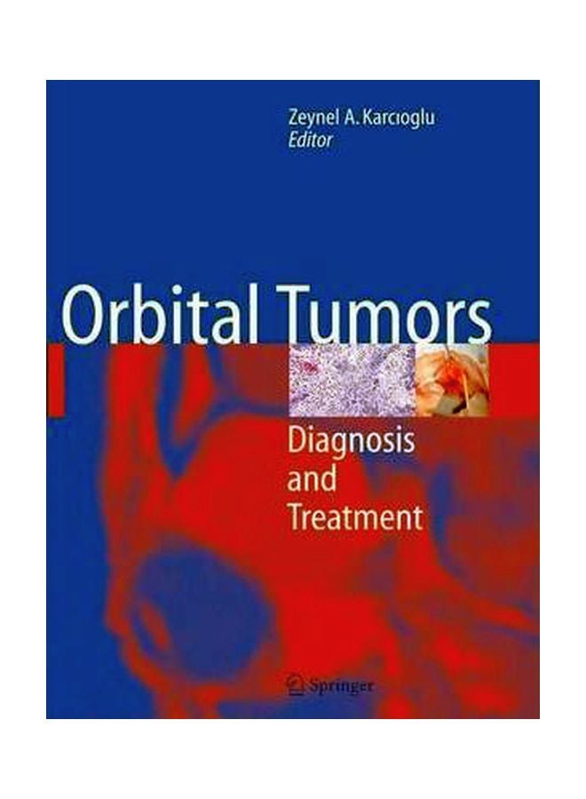 Orbital Tumors: Diagnosis And Treatment Paperback English - 05 Jan 2009 