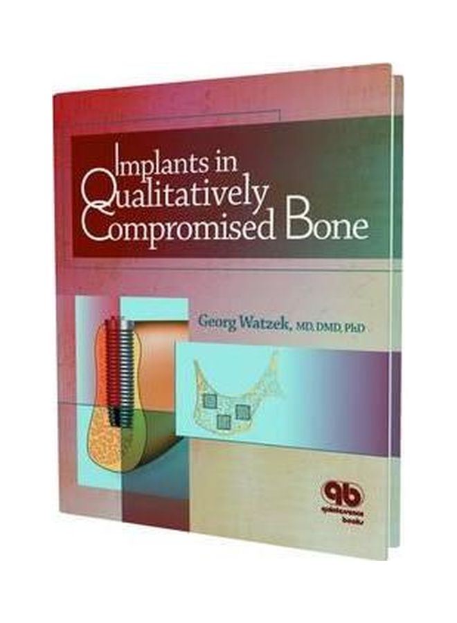 Implants In Qualitatively Compromised Bone Paperback English - 15 Feb 2004