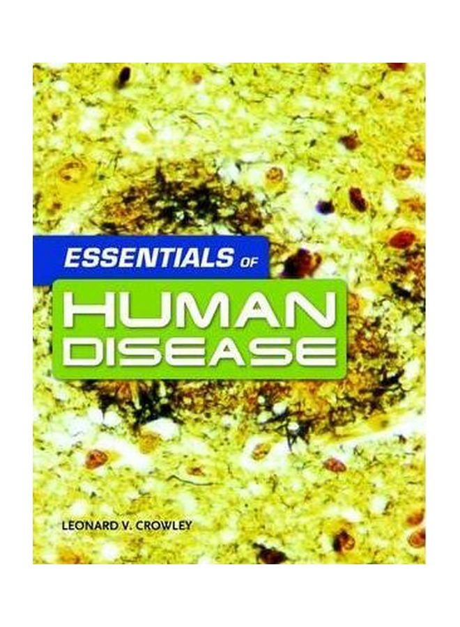 Essentials Of Human Disease paperback english - 08 Feb 2010 