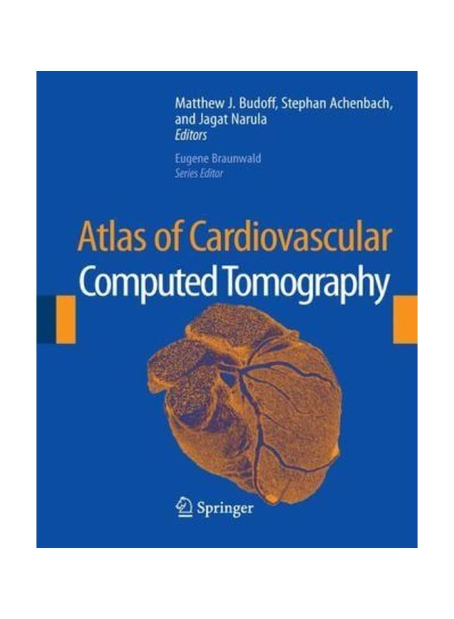 Atlas Of Cardiovascular Computed Tomography Hardcover English - 30 Aug 2007 