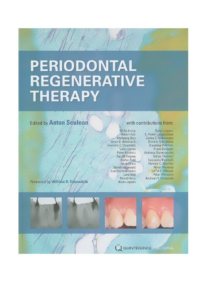 علاج تجديد الأنسجة اللثوية