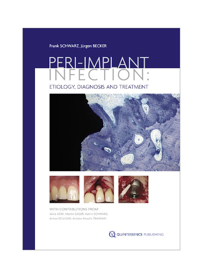 Peri-Implant Infection: Etiology, Diagnosis And Treatment Paperback English by Frank Schwarz - 40147