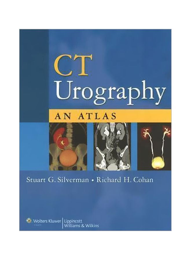 تصوير المسالك البولية بالتصوير المقطعي المحوسب: أطلس