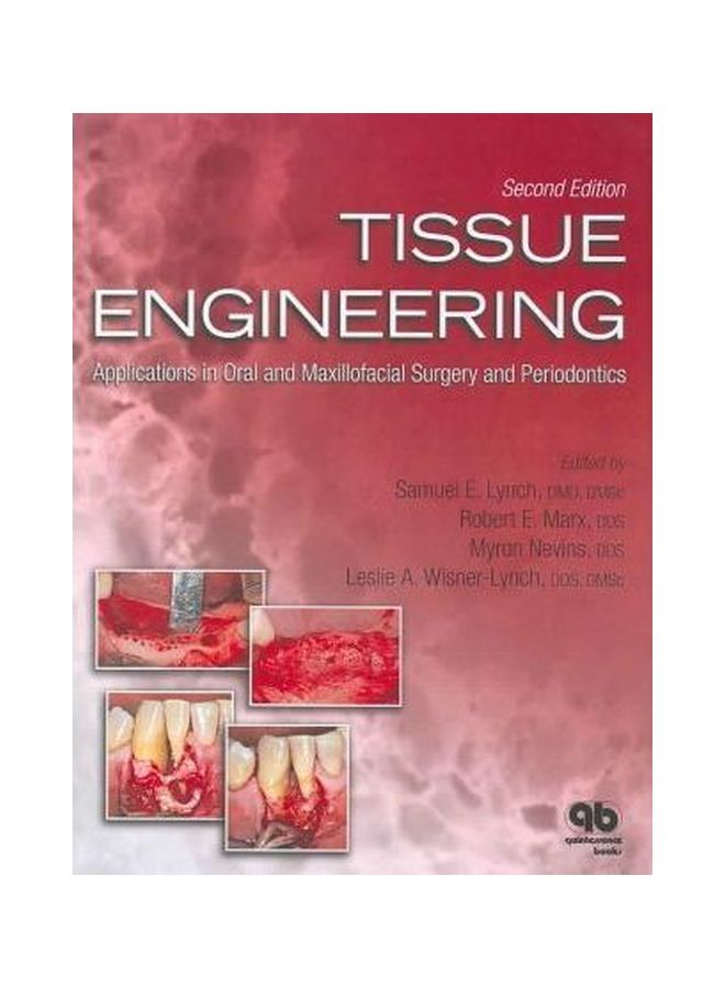 Tissue Engineering: Application In Oral And Maxillofacial Surgery And Periodontics Paperback English by Robert E. Marx - October 31, 2007