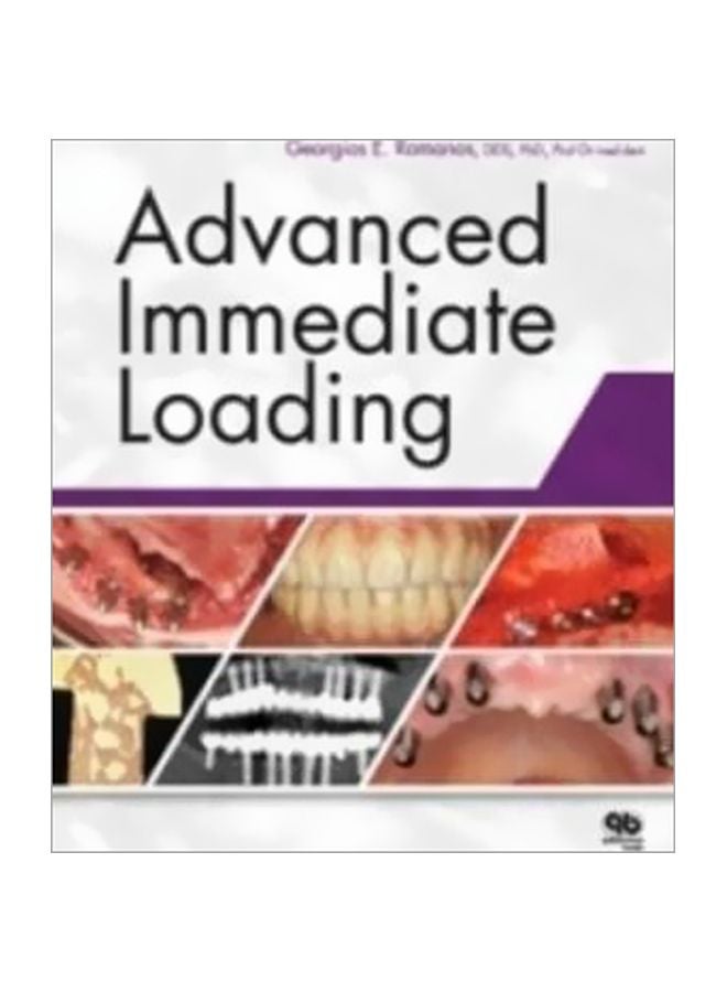 Advanced Immediate Loading Paperback English by Georgios Romanos - 01-Jun-12