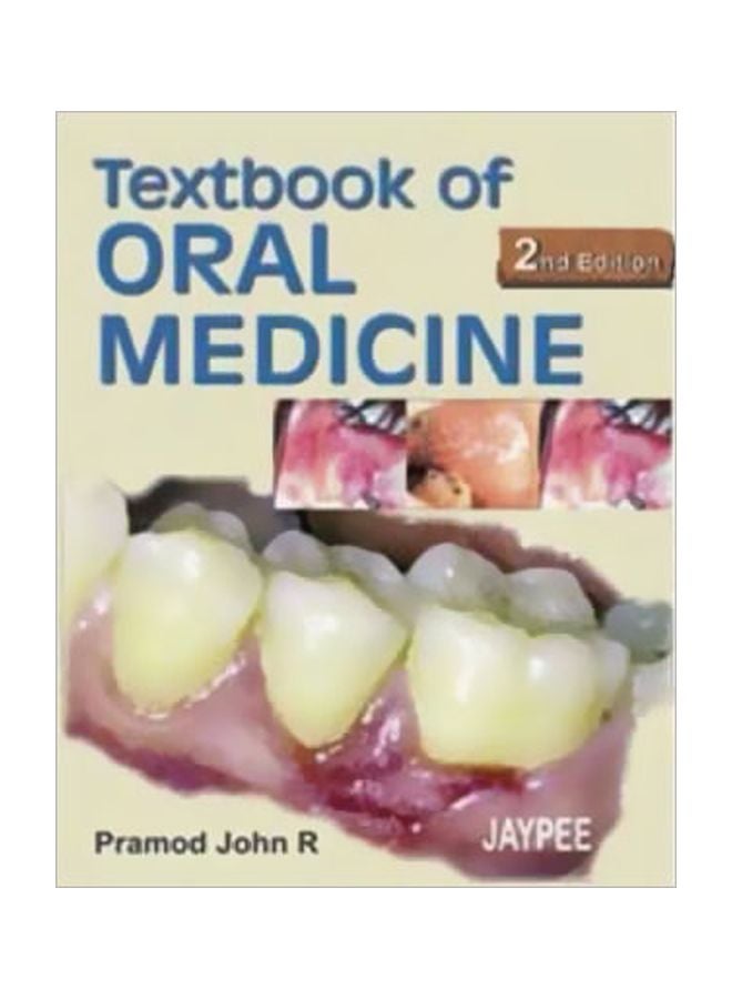 Textbook Of Oral Medicine Paperback English by Anil Govindrao Ghom - 30 Nov 2008