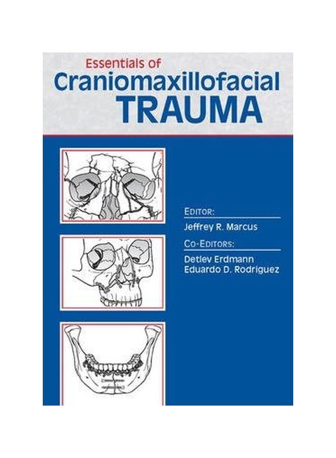 Essentials Of Craniomaxillofacial Trauma Paperback English - 22 Jul 2012