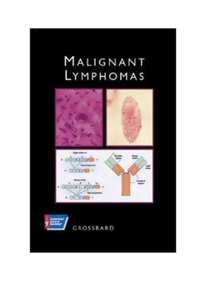 Malignant Lymphomas Hardcover English by Grossbard - 1 Jan 2002