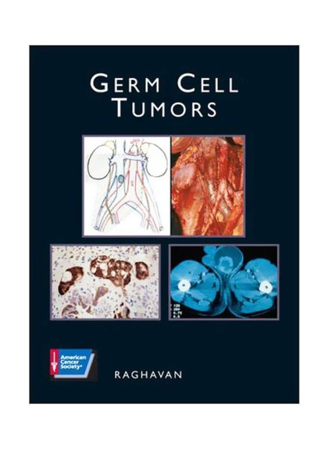 Germ Cell Tumors Paperback English by Raghavan - 16 Jul 2003 