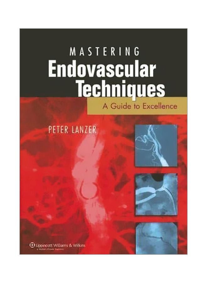 Mastering Endovascular Techniques : A Guide To Excellence Hardcover English - 01 Oct 2006 