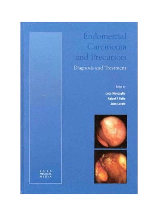Endometrial Carcinoma And Precursors : Diagnosis And Treatment Paperback English by Lurain, John - 01032018 