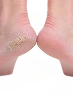 Generic Pedicure Foot File Orange/Black  - Image 2