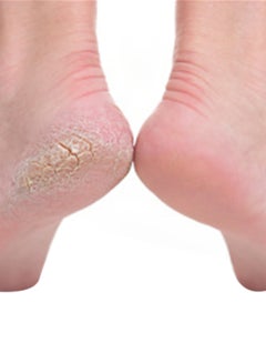 Generic Course Foot File Pink/Black  - Image 2