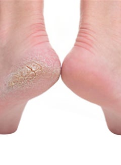 Generic Pedicure File Green/Black  - Image 2