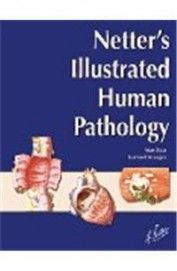 Netter's Illustrated Human Pathology Paperback English by L. Maximilian Buja - 01032018