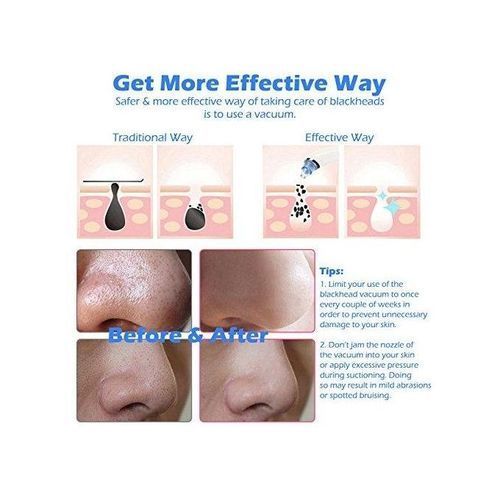 Generic Facial Pore Cleanser Blackhead Remover Rose/Gold - Image 2