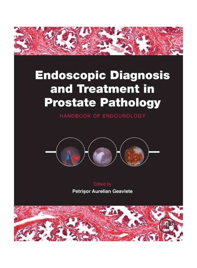 Endoscopic Diagnosis And Treatment In Prostate Pathology hardcover english - 2015 