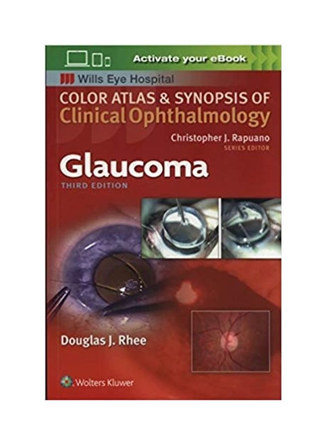 Glaucoma Color Atlas And Synopsis Of Clinical Ophthalmology paperback english - 2018 