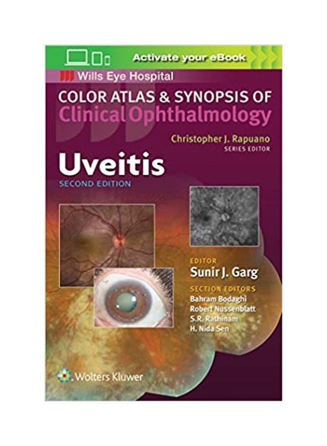 Uveitis Color Atlas And Synopsis Of Clinical Ophthalmology paperback english - 2019 