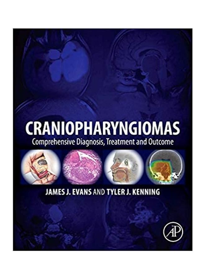 Craniopharyngiomas Comprehensive Diagnosis Treatment And Outcome hardcover english - 2015 