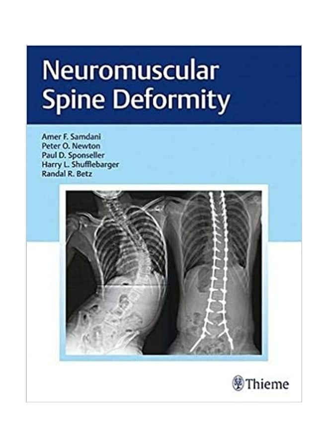 Neuromuscular Spine Deformity Hardcover English by Amer Samdani - 2018 