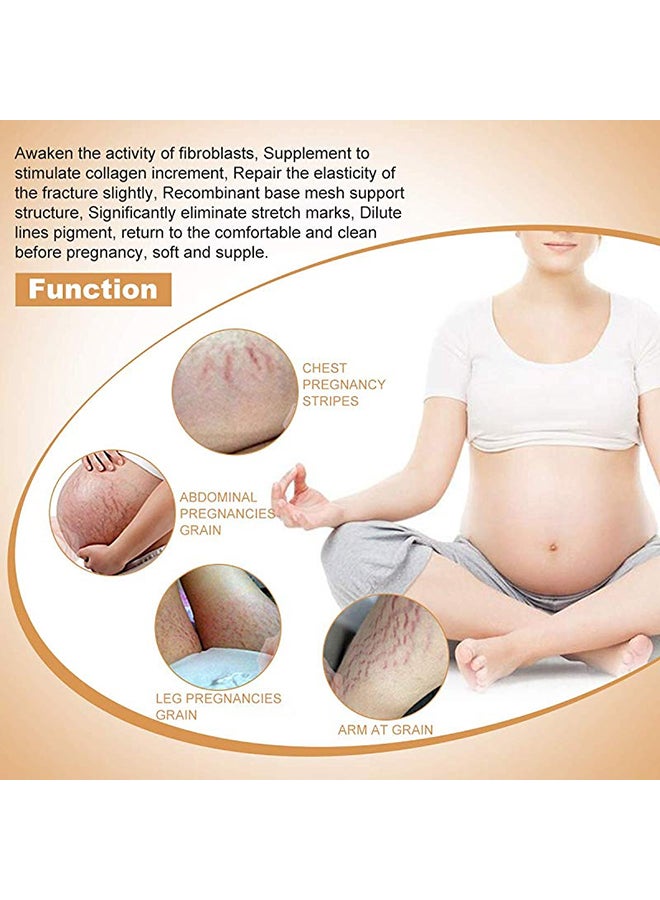 Nuonove - Stretch Mark And Scar Removal Cream 50ml - Image 1