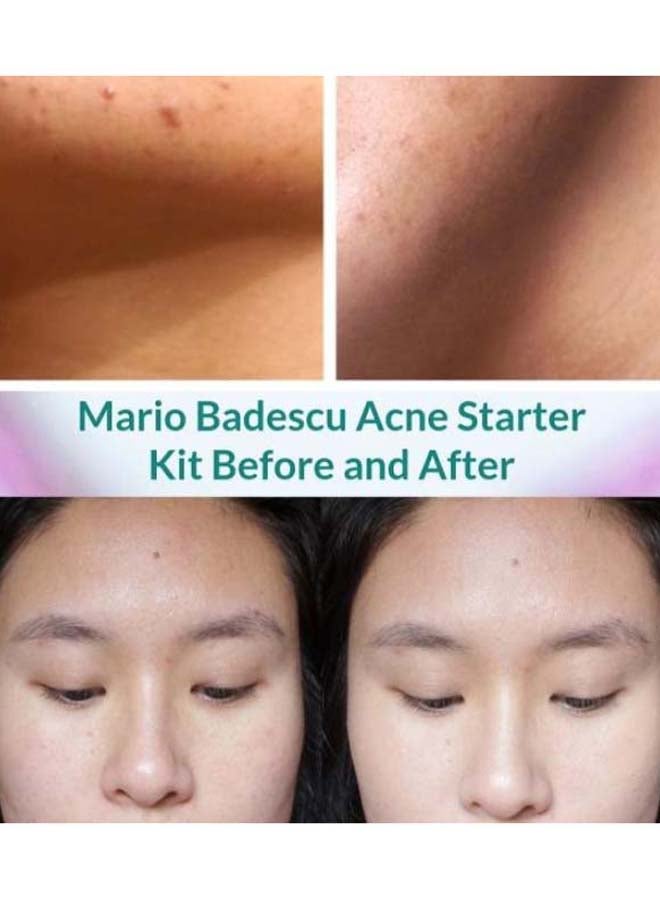 MARIO BADESCU - Acne Repair Kit of 3 29ml, 29ml, 14g - Image 1