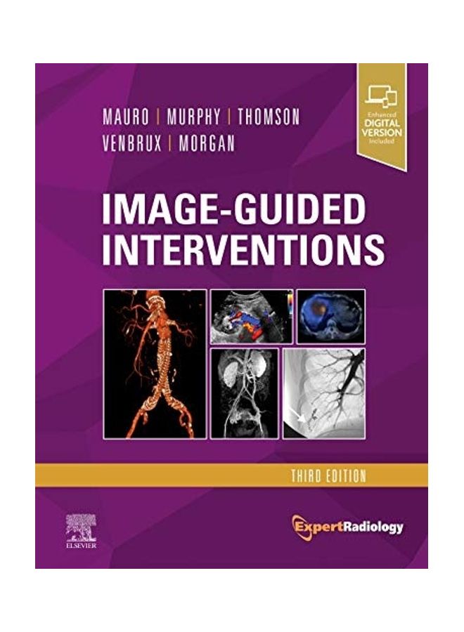 Image-Guided Interventions: Expert Radiology Series paperback 